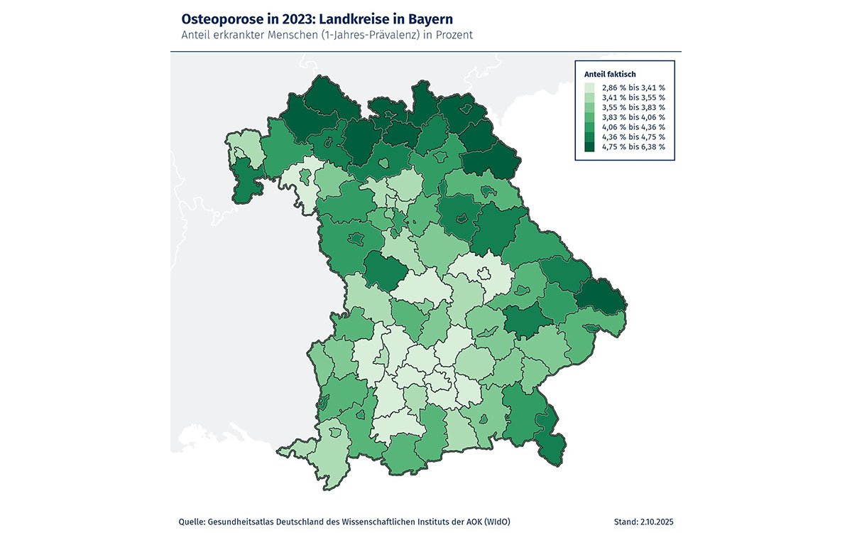 Welt-Osteoporose-Tag: Warum Kaufbeuren besonders betroffen ist